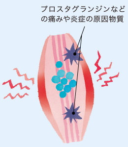 プロスタグランジンなどの痛みや炎症の原因物質