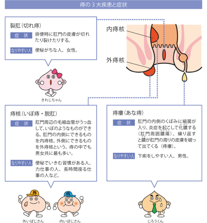 痔の3大疾患と症状