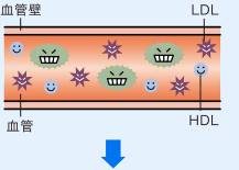 血液中にVLDLが増え過ぎると、LDLが増産され、LDLとHDLのバランスが崩れる。