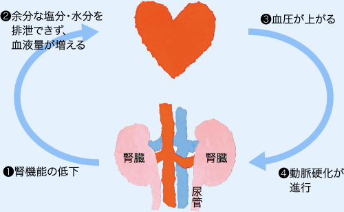 1.腎機能の低下
                  2.余分な塩分・水分を排泄できず、血液量が増える
                  3.血圧が上がる
                4.動脈硬化が進行