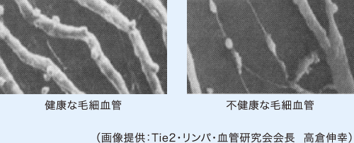 健康な毛細血管は太くはっきり見えるが、不健康な毛細血管は見るからに弱々しい。
						（画像提供：Tie2・リンパ・血管研究会会長  高倉伸幸）