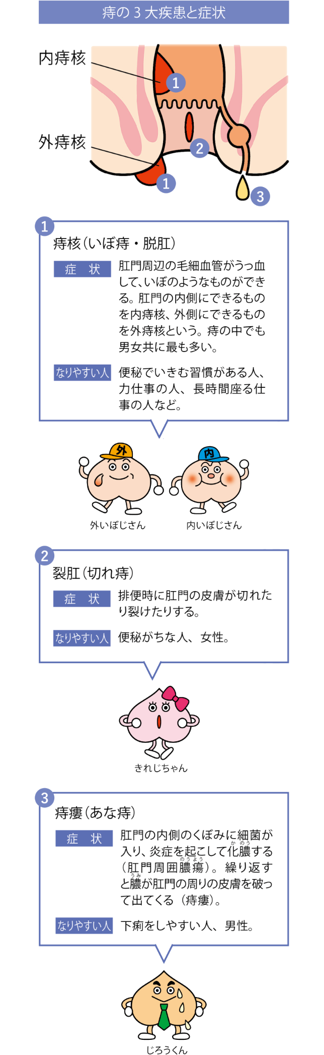 困っていませんか 痔の症状 公式 大正製薬ダイレクトオンラインショップ