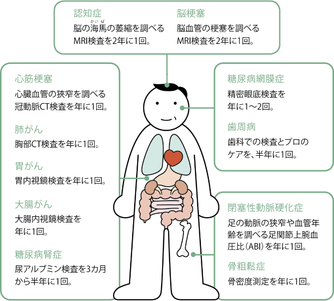 認知症…脳の海馬の萎縮を調べるMRI検査を2年に1回。　脳梗塞…脳血管の梗塞を調べるMRI検査を2年に1回。　糖尿病網膜症…精密眼底検査を年に1～2回。　歯周病…歯科での検査とプロのケアを、半年に1回。　心筋梗塞…心臓血管の狹窄を調べる冠動脈CT検査を年に1回。　肺がん…胸部CT検査を年に1回。　胃がん…胃内視鏡検査を年に1回。　大腸がん…大腸内視鏡検査を年に1回。　糖尿病腎症…尿アルブミン検査を3カ月から半年に1回。　閉塞性動脈硬化症…足の動脈の狭窄や血管年齢を調べる足関節上腕血圧比（ABI）を年に1回。　骨粗鬆症…骨密度測定を年に1回。