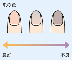 爪の色　ほんのりピンク色ほど良好、黒ずむほど不良